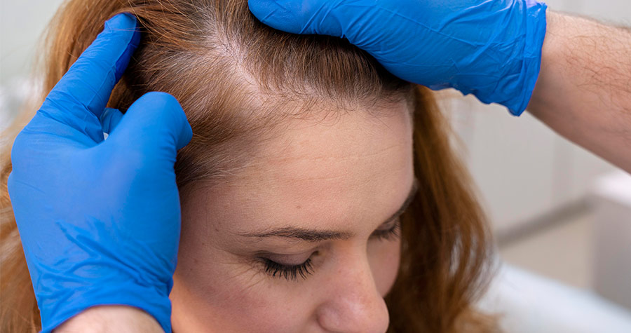 Efeom – Queda de cabelo e unhas fracas: O que fazer para resolver este ...